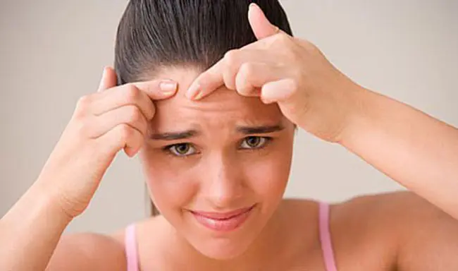 student health skin acne tips student health skin acne tips